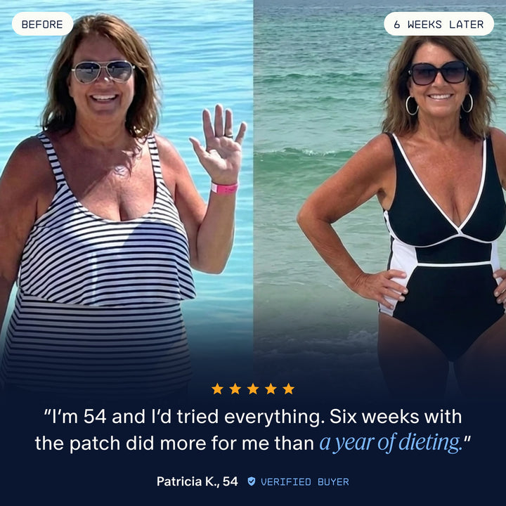 Patricia K., 54, before and after 6 weeks with the Slim Control patch