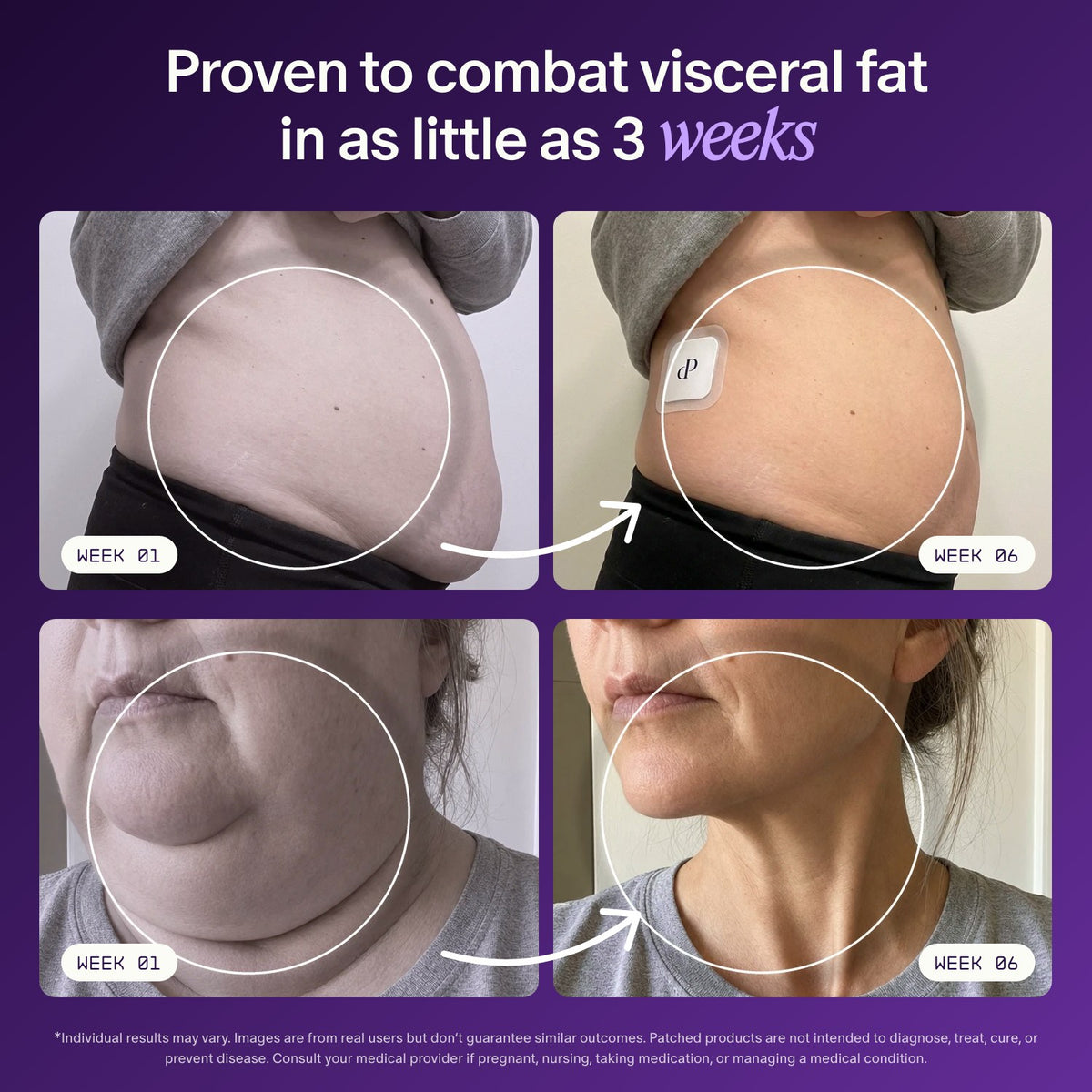 Before and after results
