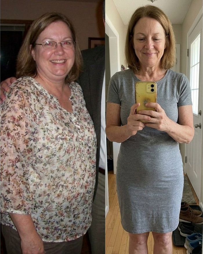 Theresa M. before and after