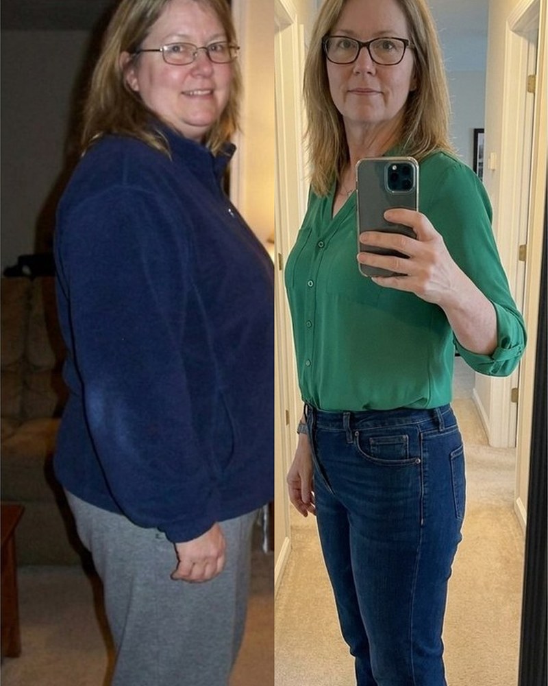 Carol B. before and after Night Burn