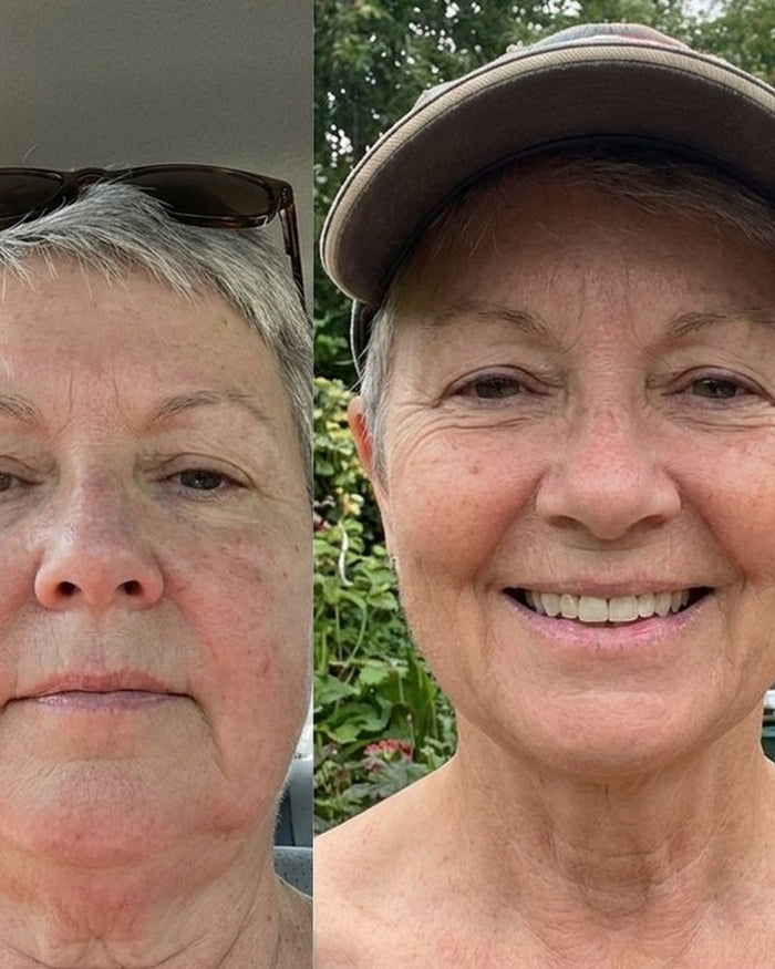 Janet W. before and after