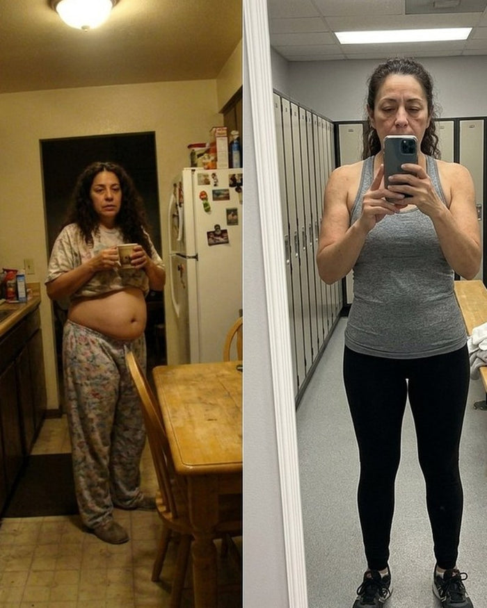 Sandra P. before and after