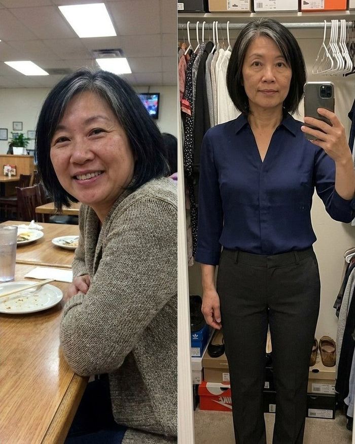 Rhonda L. before and after