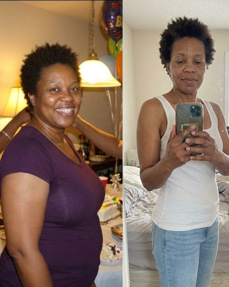 Linda R. before and after Night Burn
