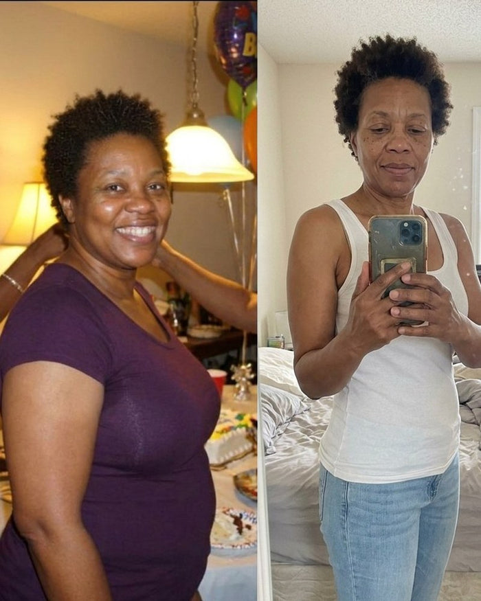 Linda R. before and after