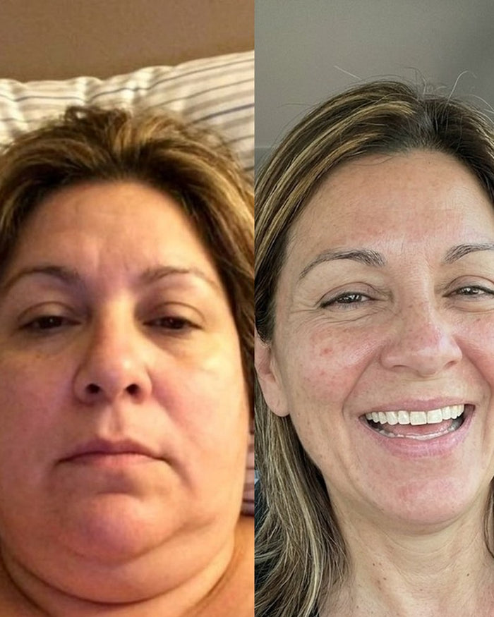 Lisa M. before and after