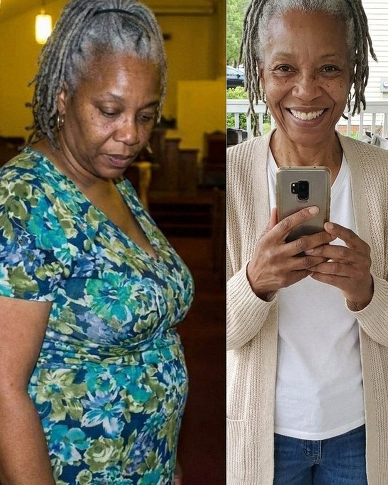 Denise K. before and after Night Burn