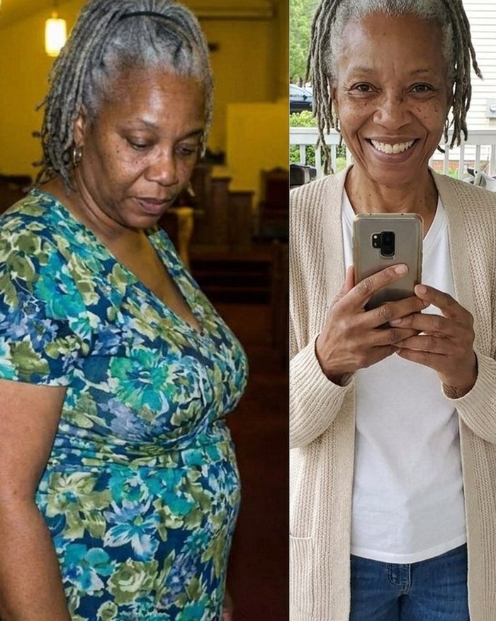 Donna J. before and after