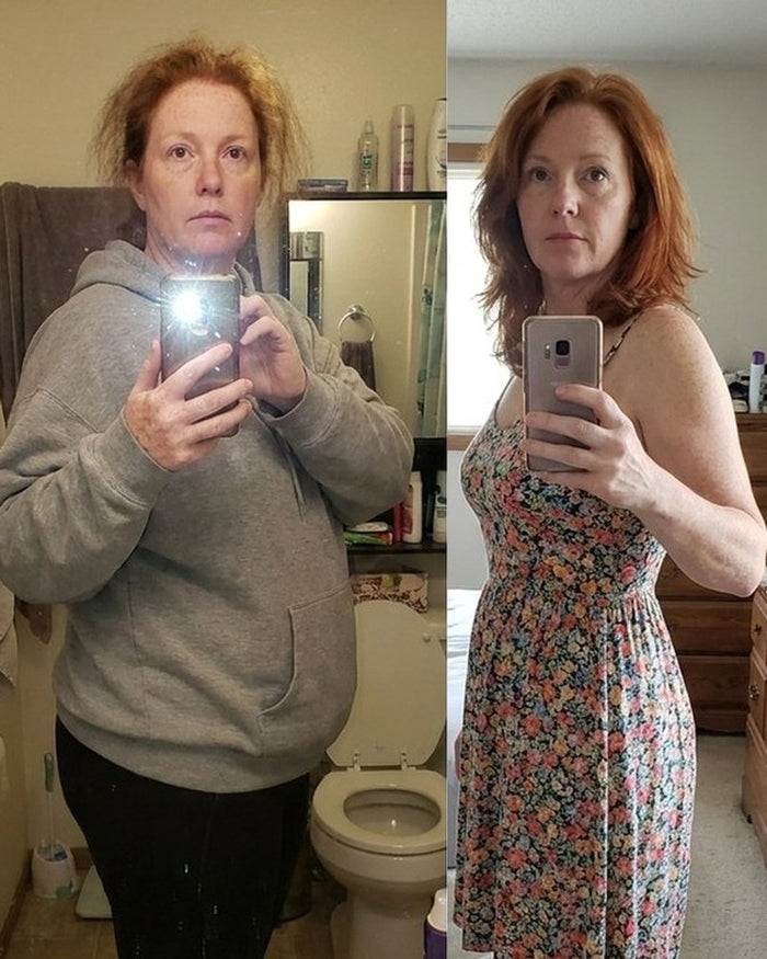 Debra A. before and after