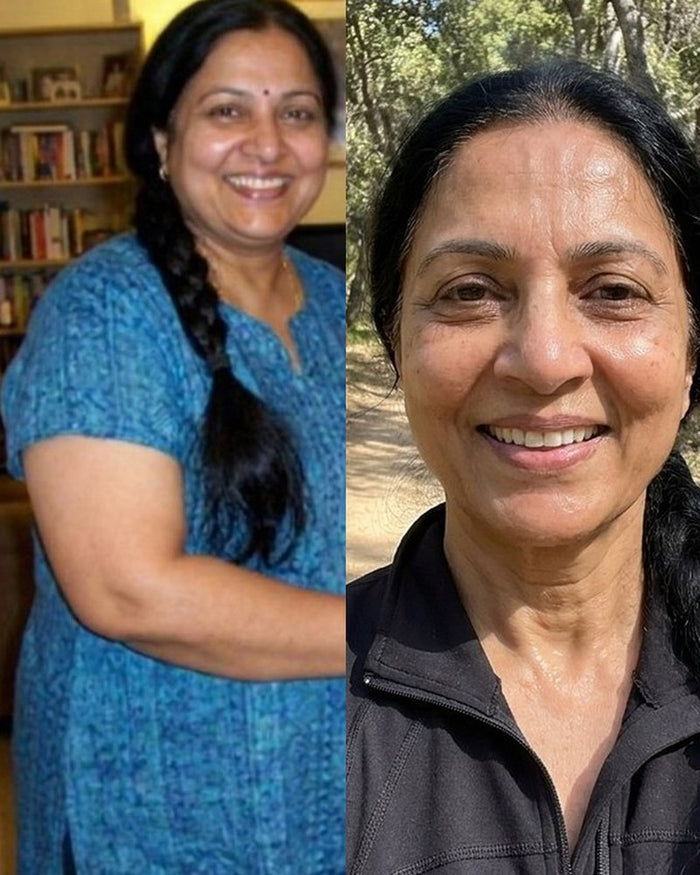 Brenda F. before and after