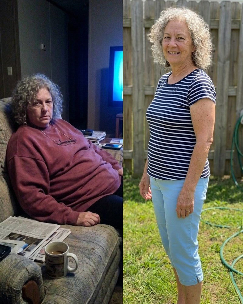 Gail H. before and after Night Burn